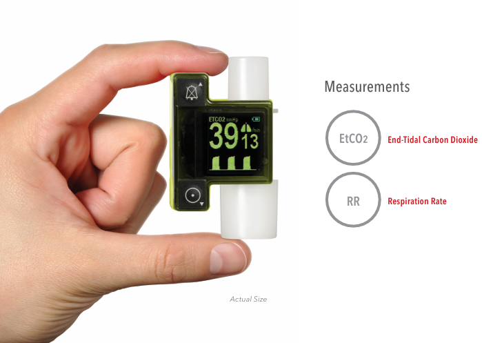 EMMA2 Portable Real-Time Capnography