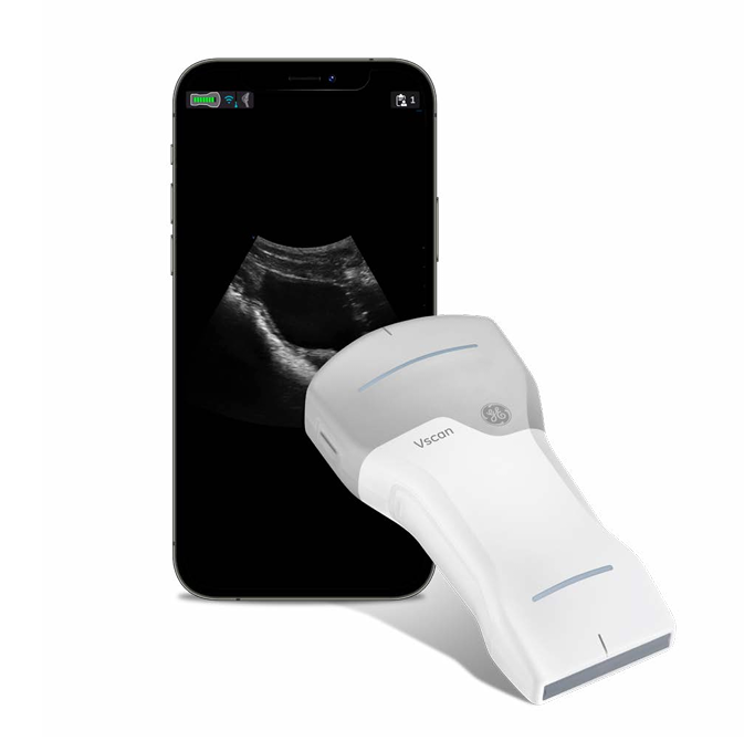 GE VScan Air CL Handheld Ultrasound
